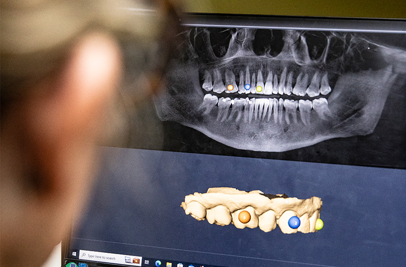 Lifestyle photography example for dental practice Masterpiece Smiles. A dental professional is using a computer to look at an x-ray of a jaw and a model of someone's teeth. Spots are marked with colored dots.